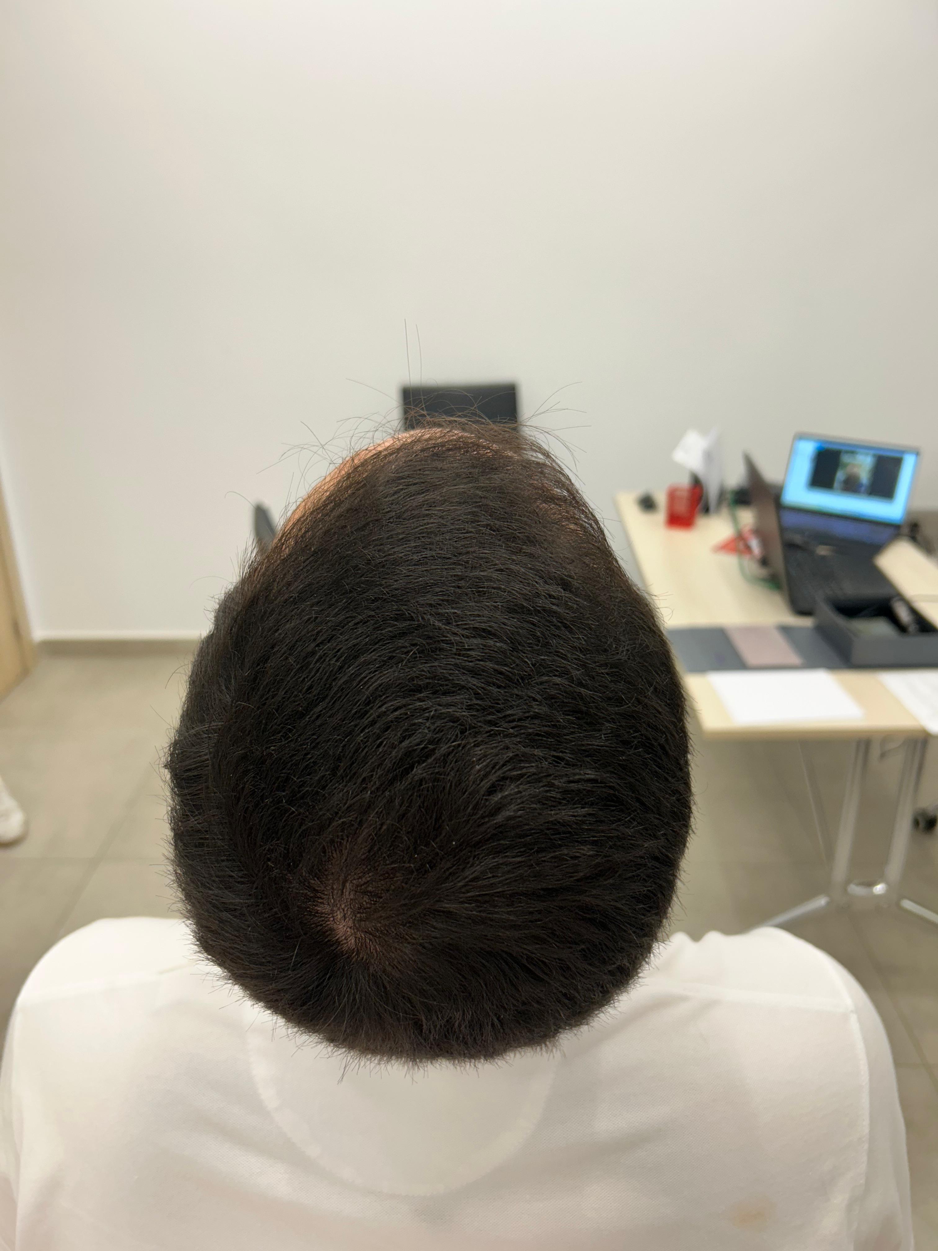 Después del tratamiento · Caso 1